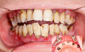Dentisti Brescia